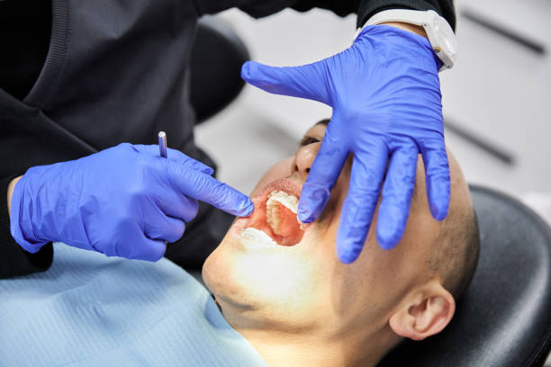 Best Emergency Dental Care for Sports Injuries in Browns Point, WA